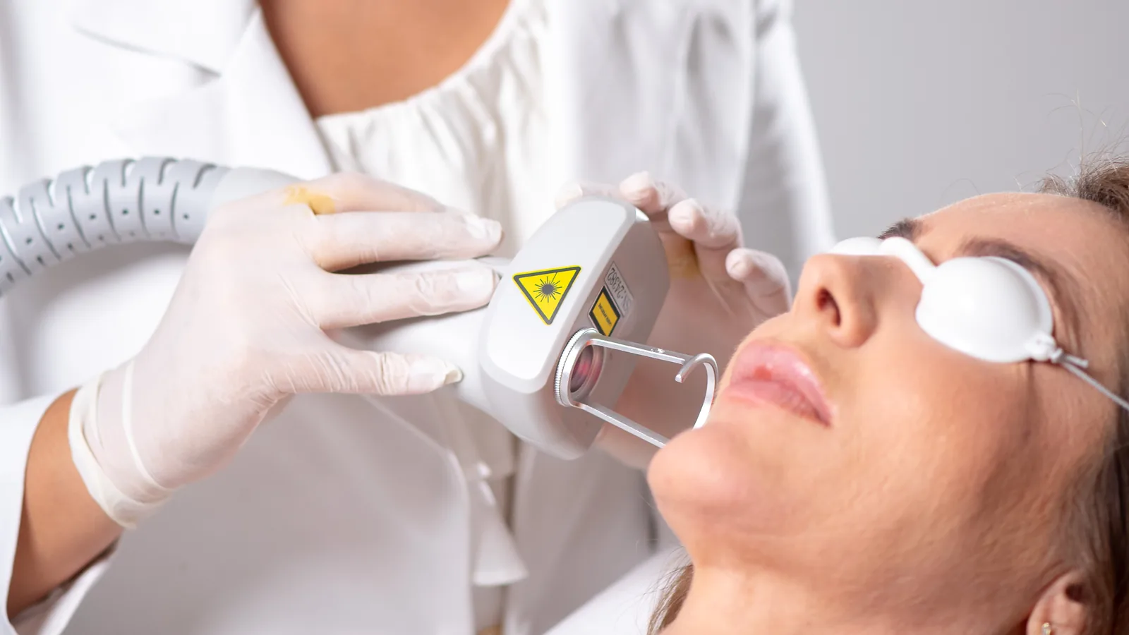 Mãos com luvas apoiam a peça de mão do laser Joovier na bochecha da paciente, que usa protetores oculares brancos
