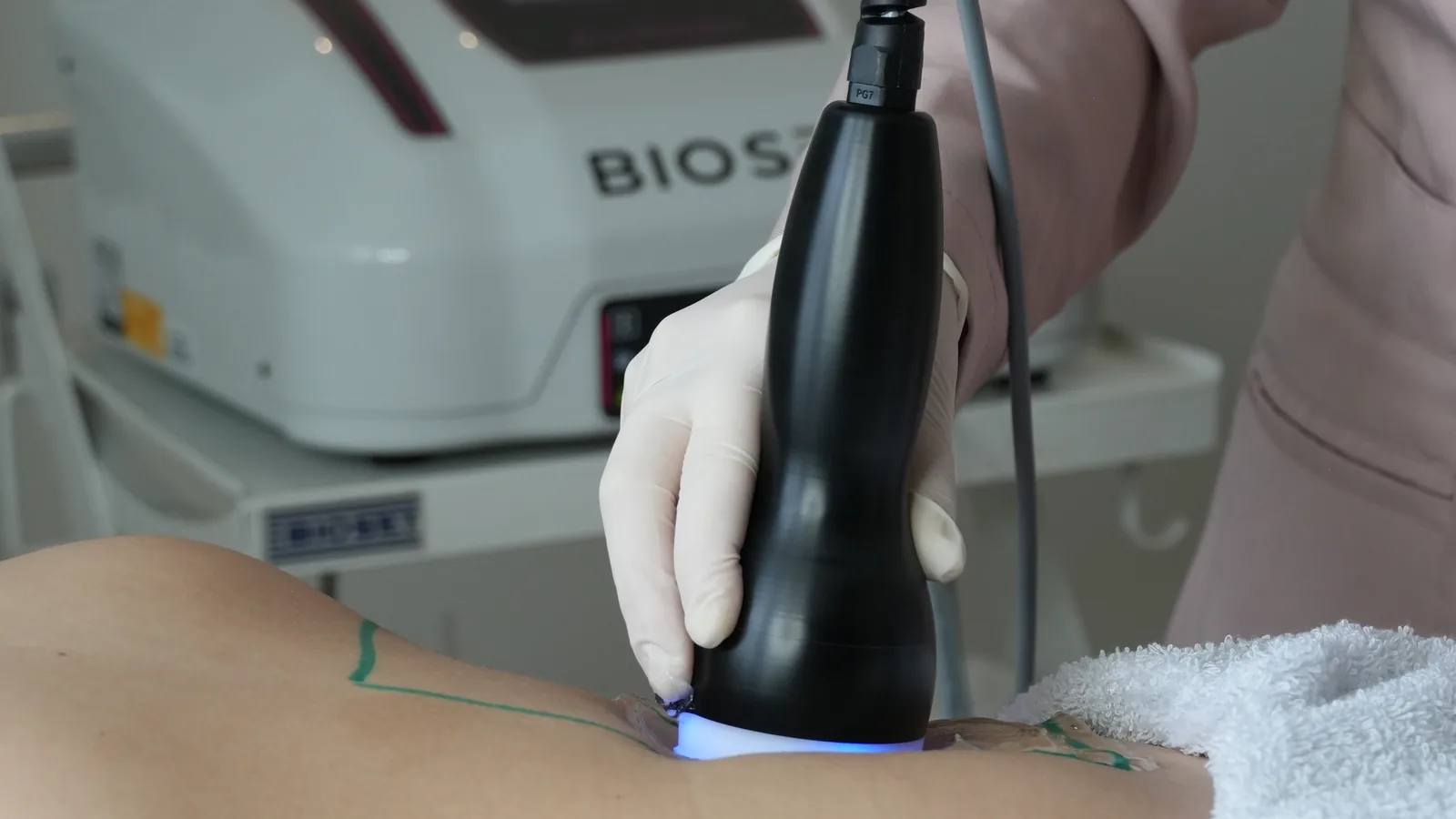 Profissional de luvas apoia o transdutor do Cavitouch no abdome demarcado da paciente, com o aparelho no carrinho ao fundo